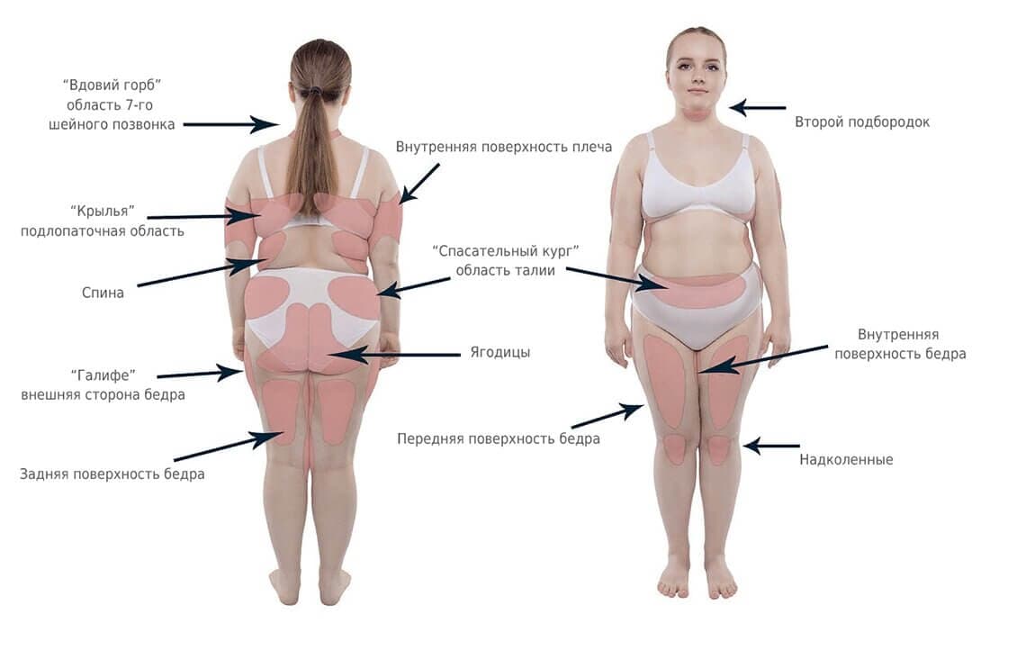 Причины лишнего веса у людей